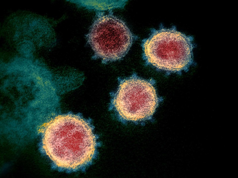 SARS-CoV-2 Coronavirus Pennsylvania