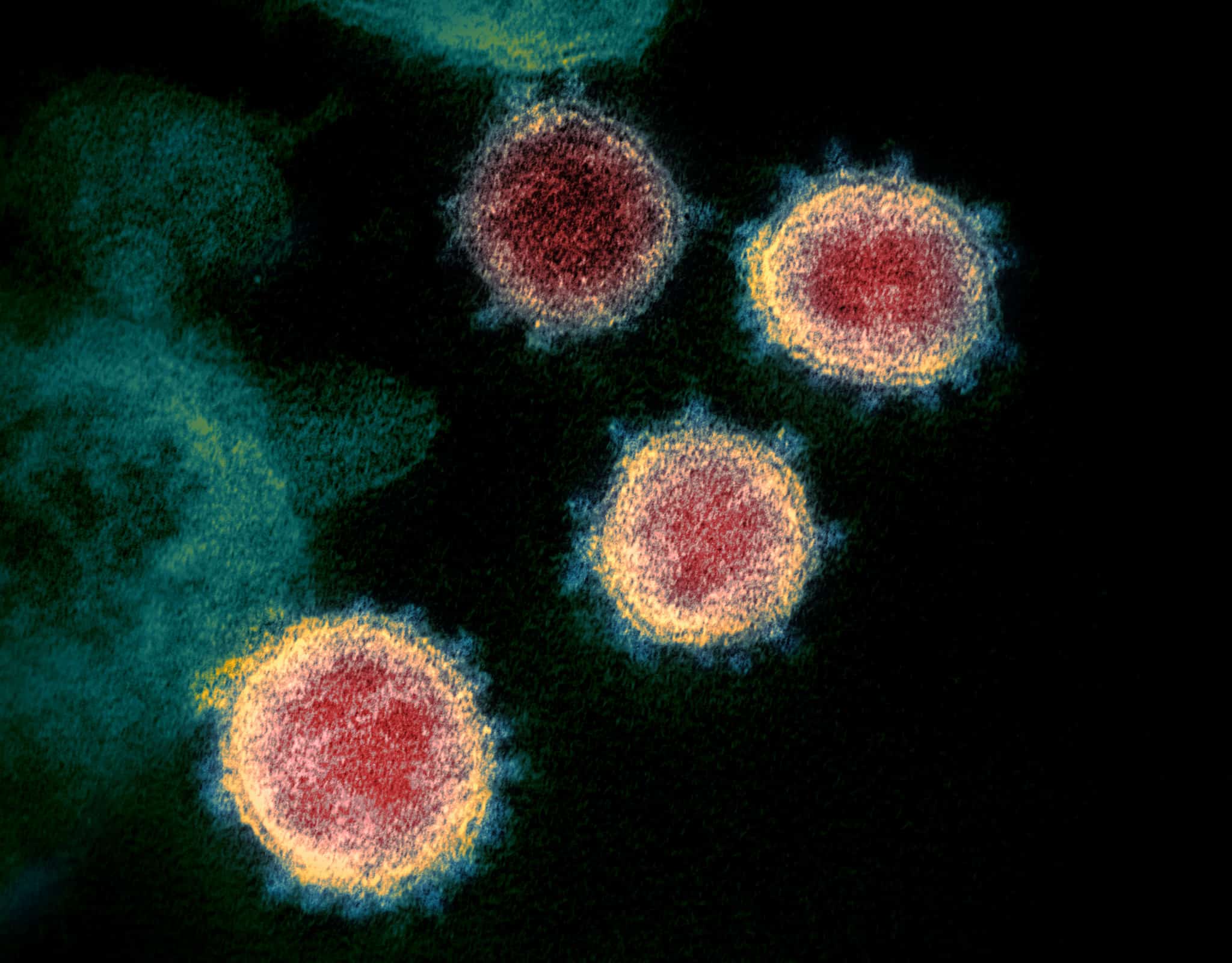 SARS-CoV-2 Coronavirus Pennsylvania